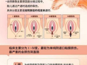 女生一天多次同房会肿胀吗 女生一天多次同房会阴部肿胀吗？