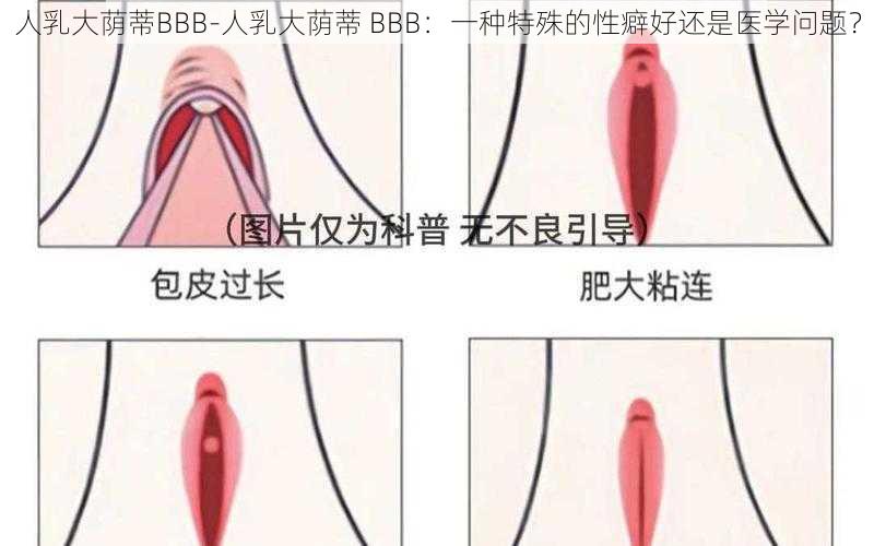 人乳大荫蒂BBB-人乳大荫蒂 BBB：一种特殊的性癖好还是医学问题？