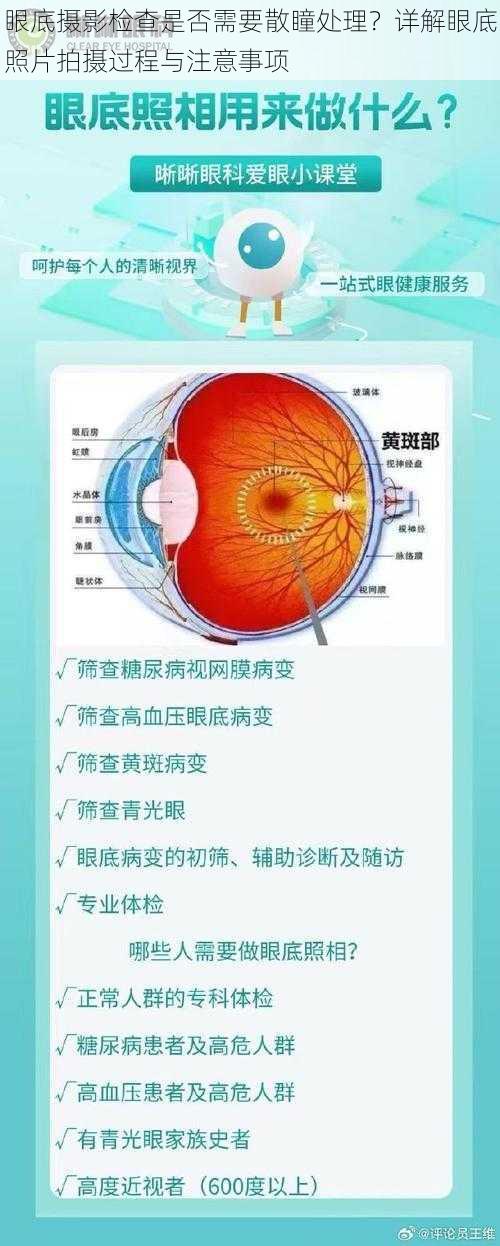 眼底摄影检查是否需要散瞳处理？详解眼底照片拍摄过程与注意事项